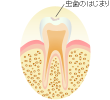 ＣＯ ： 初期の虫