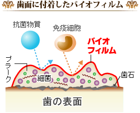 歯面に付着したバイオフィルム