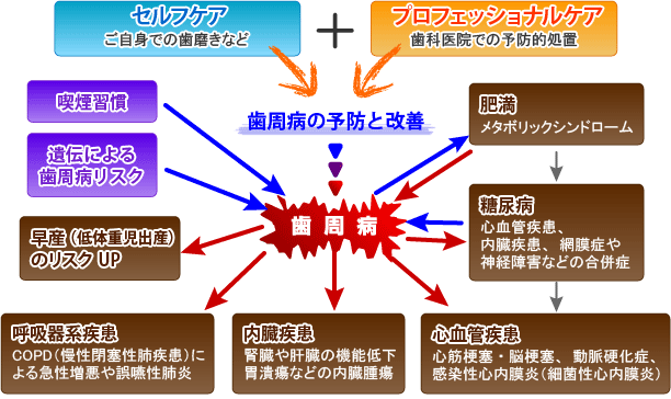 歯周病が要因となりえる様々な疾患