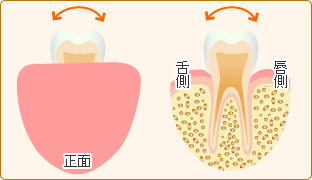 歯の動揺度検査