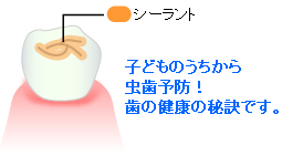 大切な乳歯を虫歯から守る歯のバリア