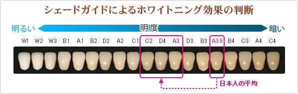 シェードガイド