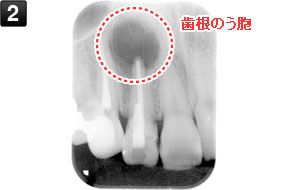 初診時デンタル（レントゲン写真）