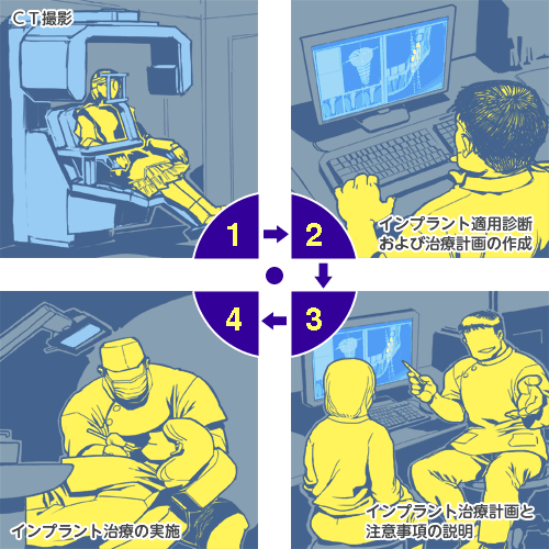 ＣＴ撮影からインプラント治療までの流れ