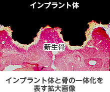 インプラントと骨の一体化を表す拡大画像