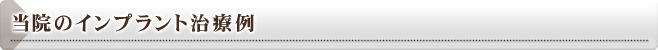 当院のインプラント治療例