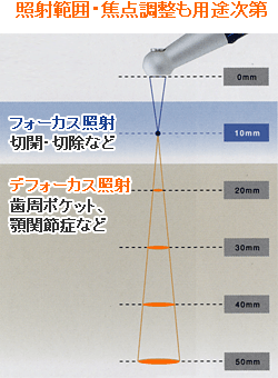 照射範囲・焦点調整も用途次第