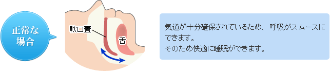 正常な場合