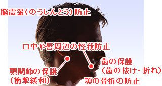 マウスガードで防止できるケガやトラブル