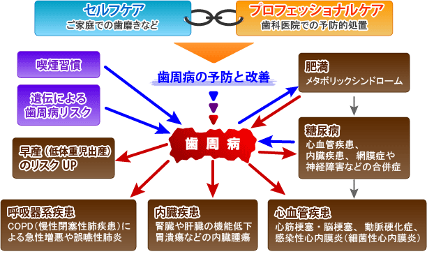 歯周病・歯槽膿漏 | 高知 安光歯科 | いの町の歯医者さん