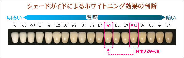 シェードガイド