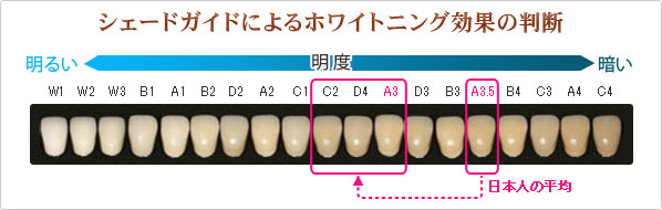シェードガイド