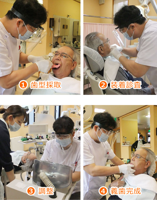 義歯・入れ歯 | 高知 安光歯科 | いの町の歯医者さん